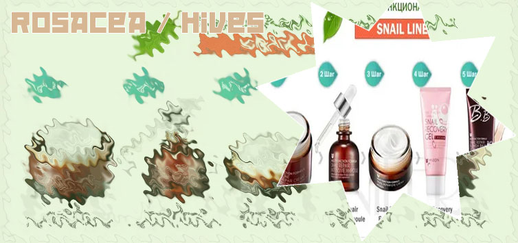 Korean products for rosacea